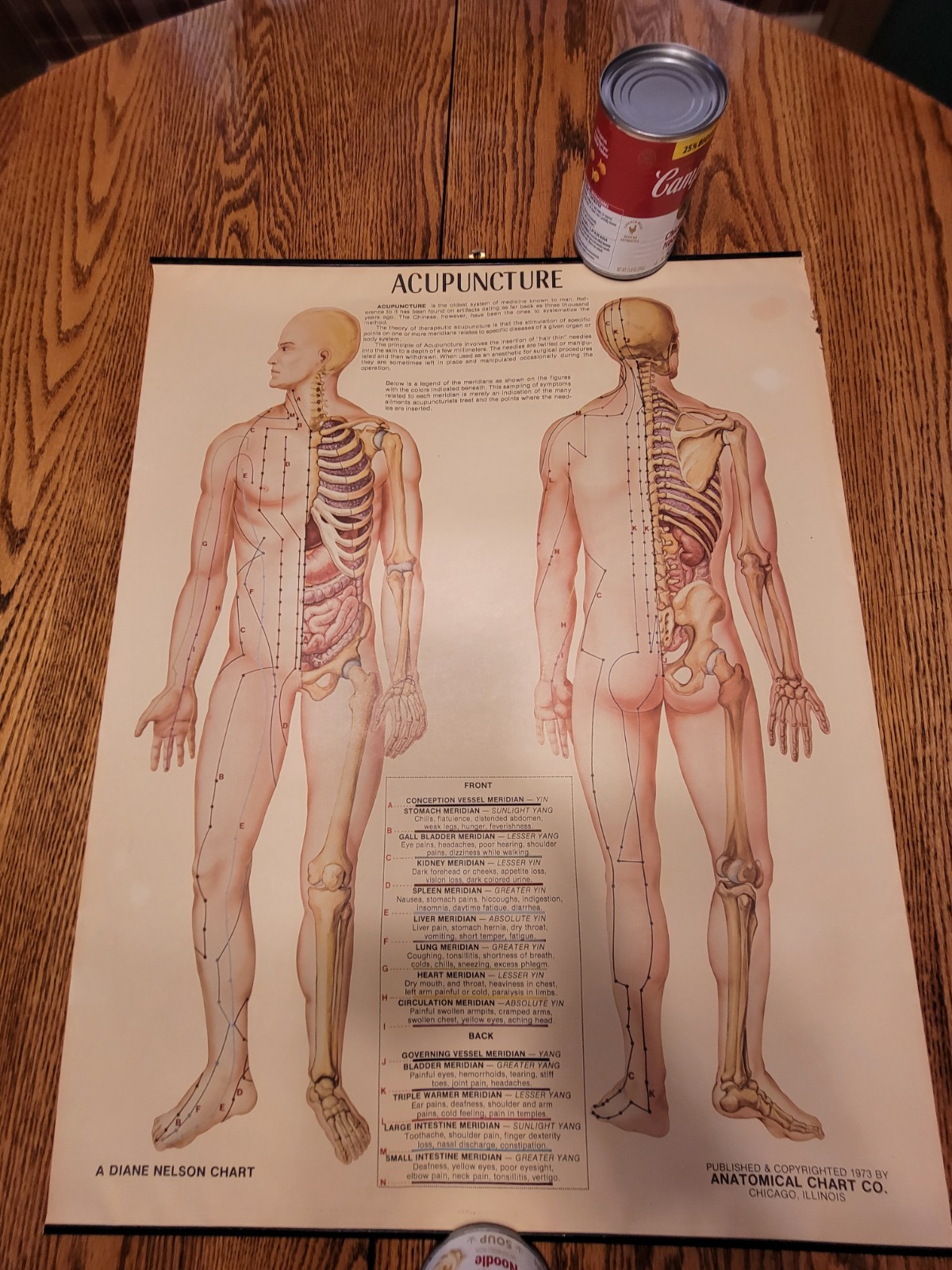 Vintage Diane Nelson Acupuncture Anatomical Chart
