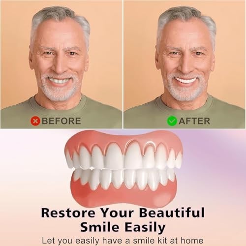 Silicone Reline Denture Kit for Upper & Lower Teeth, Soft Comfortable Veneers