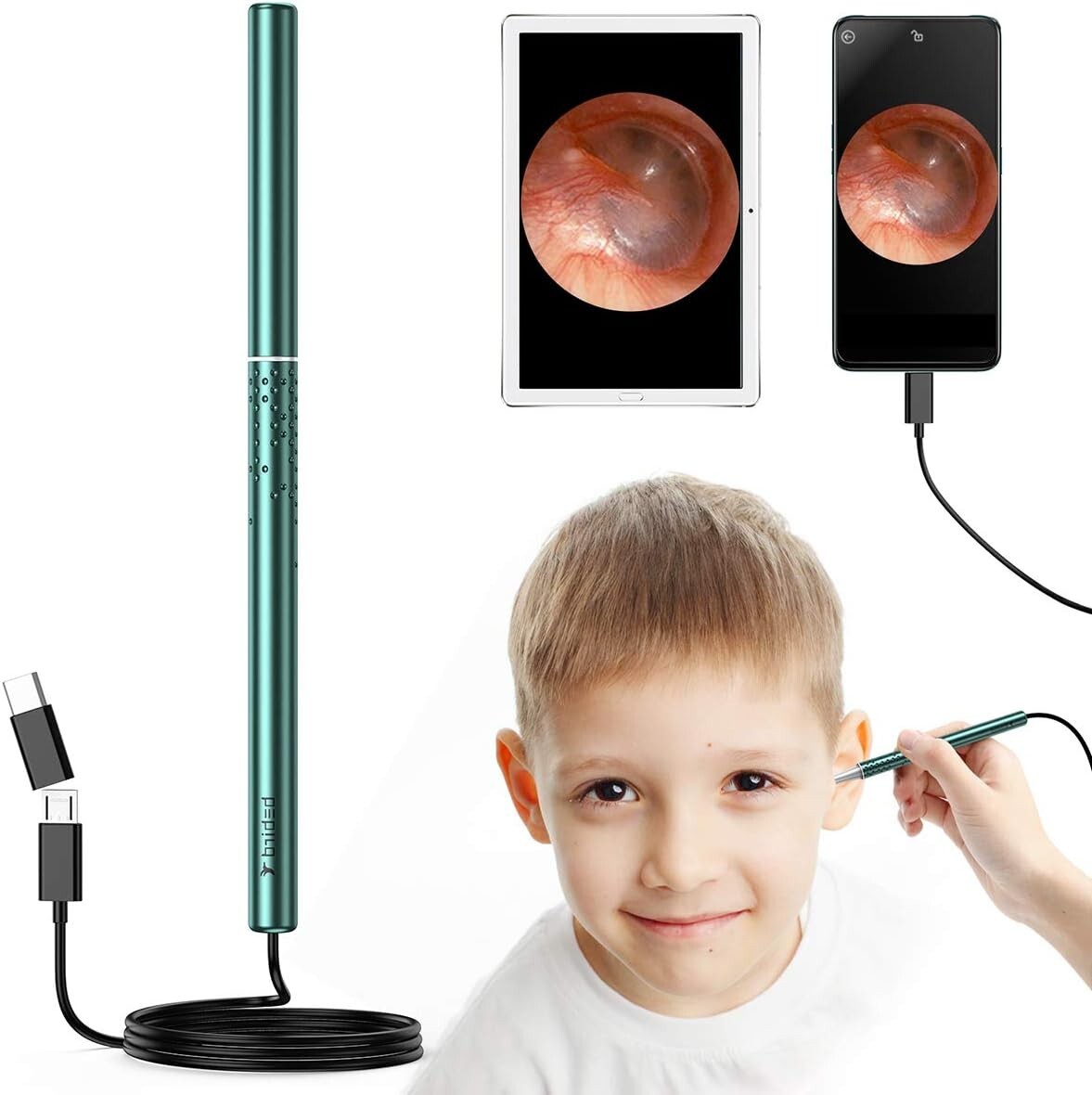 Feltom Earwax Remover Kit, Ear Camera Endoscope 1080P HD with 6 LED Lights New