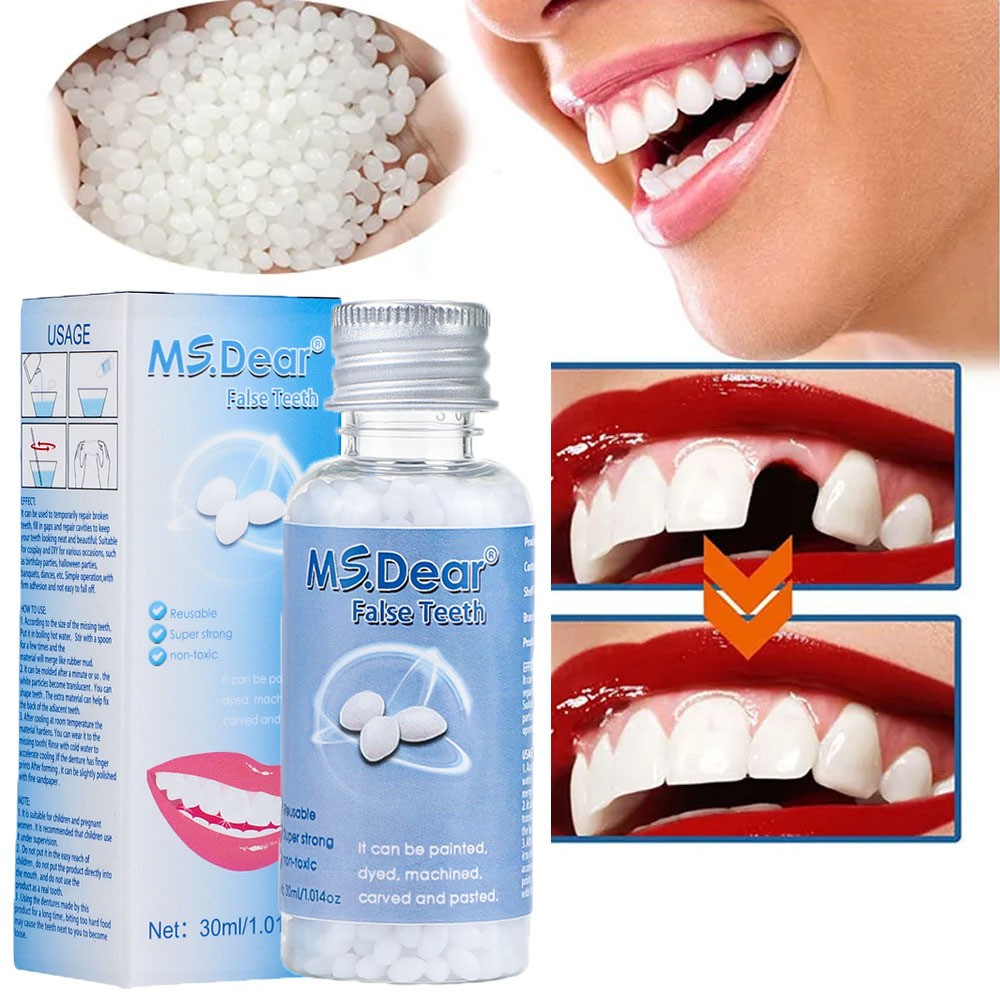 Tooth Repair Kit - Temporary Teeth Replacement Kit for Missing & Broken Teet