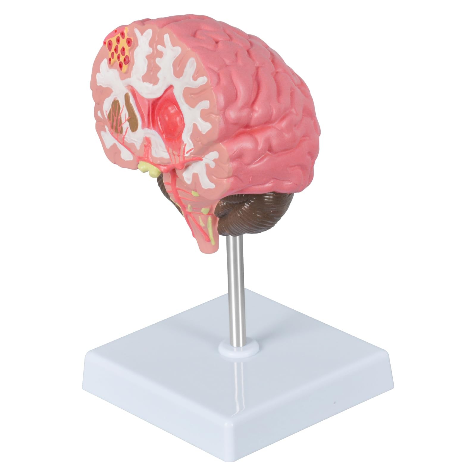 Brain Stroke Anatomy Model, Life-Size Human Brain Structure Anatomical Model,...