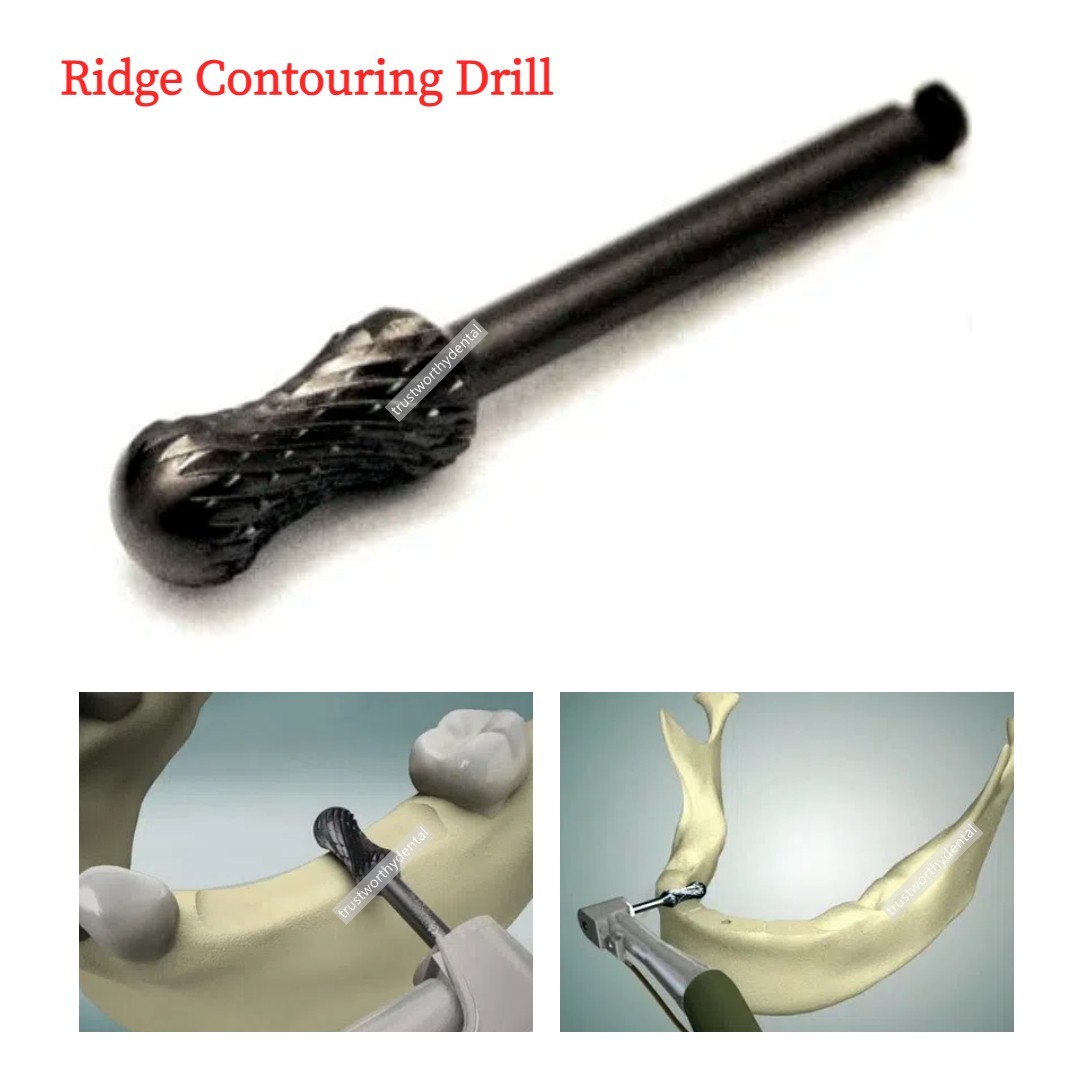 Dental Ridge Contouring Burs Sculpting Drill Trimming Hourglass Reduction