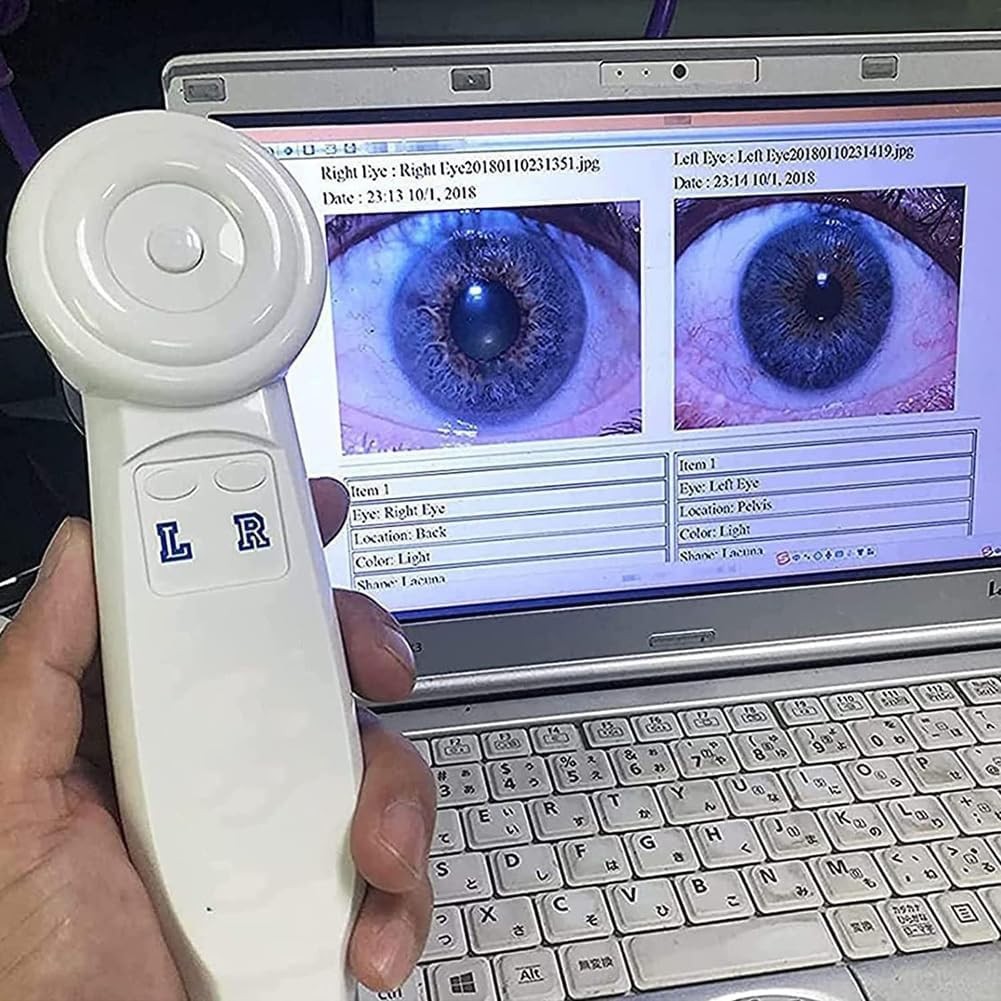 5.0MP USB Iris Analysis Camera Eyes Analyzer Iridology English/Spanish Software