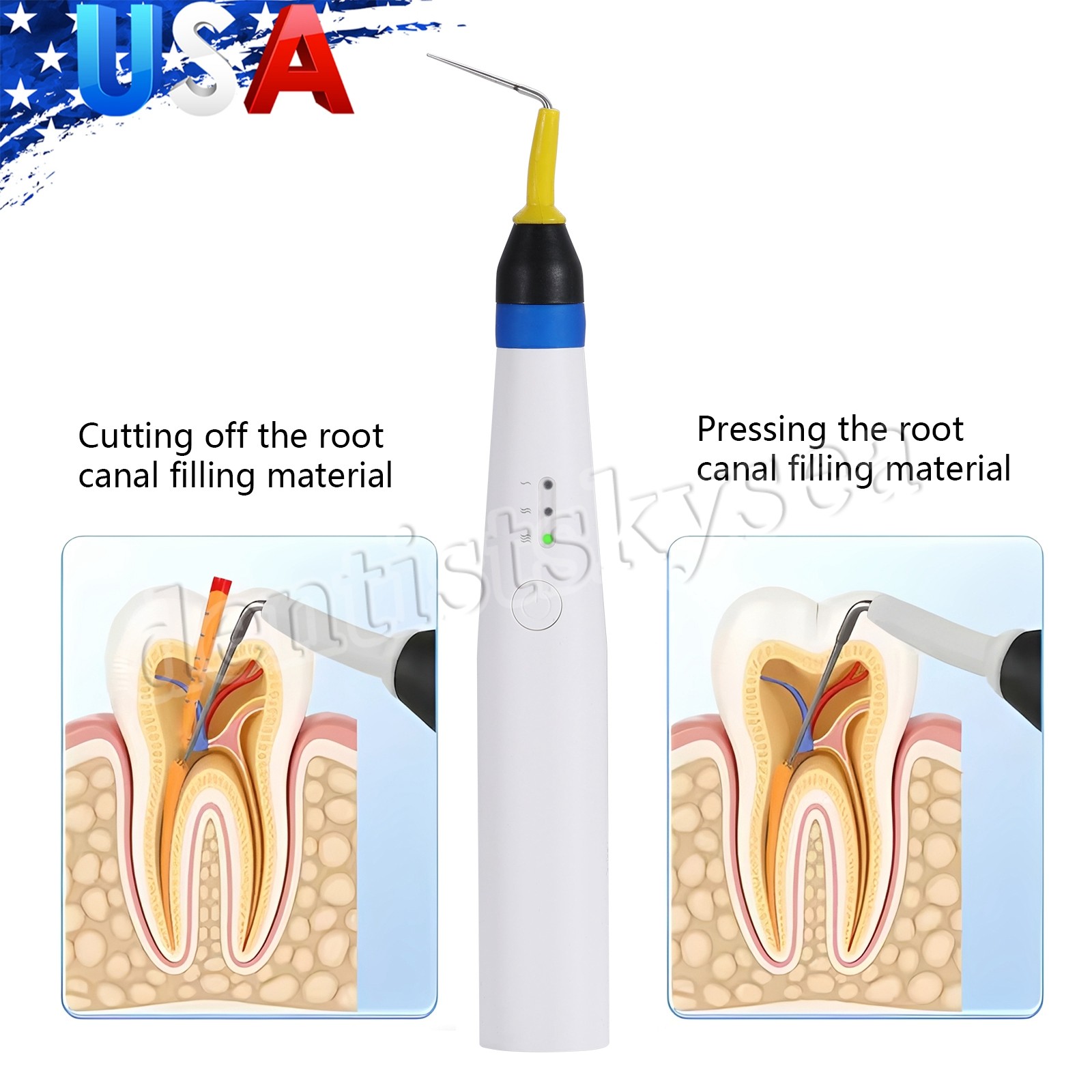 5Pcs Cordless Gutta Percha Obturation System Endo Heated Pen With 2 Tips