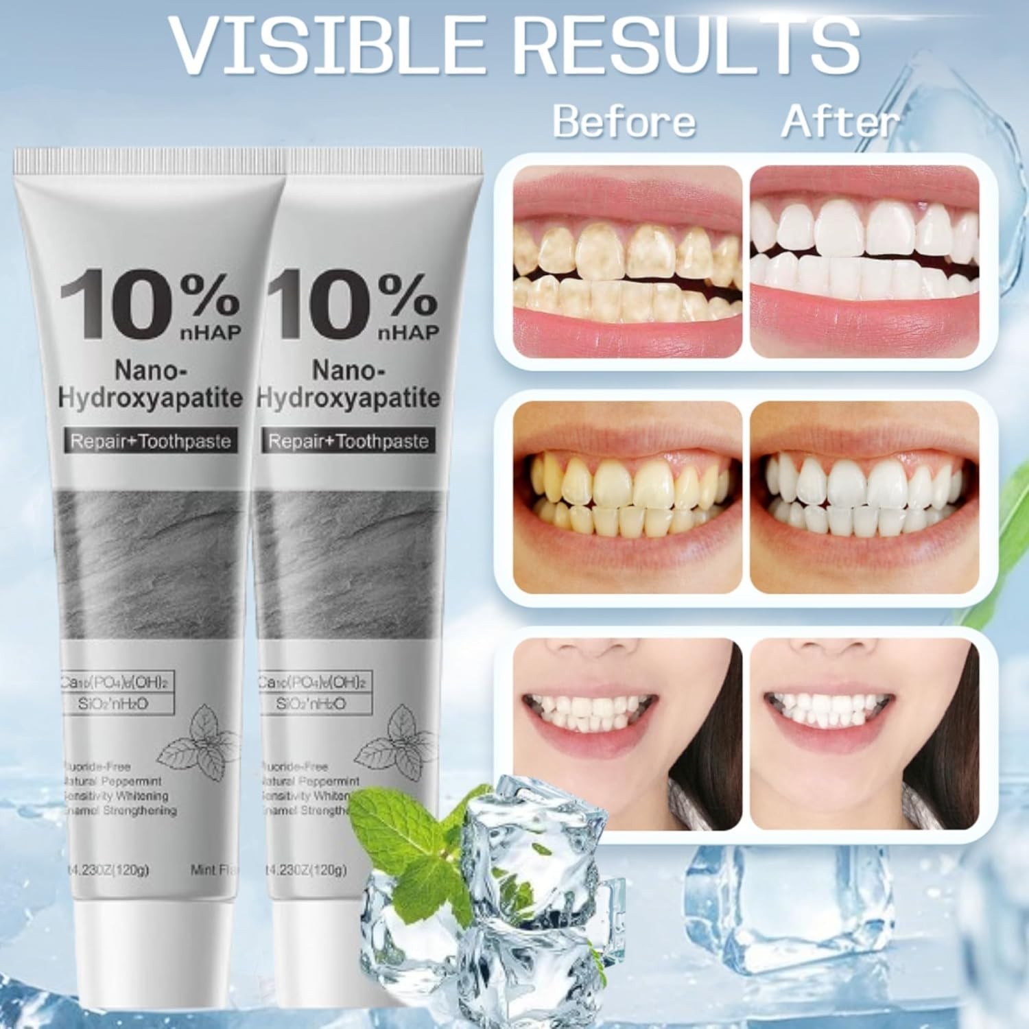 2Pcs 10% Hydroxyapatite Toothpaste,Nano-Hydroxyapatite Toothpaste 4.23 oz