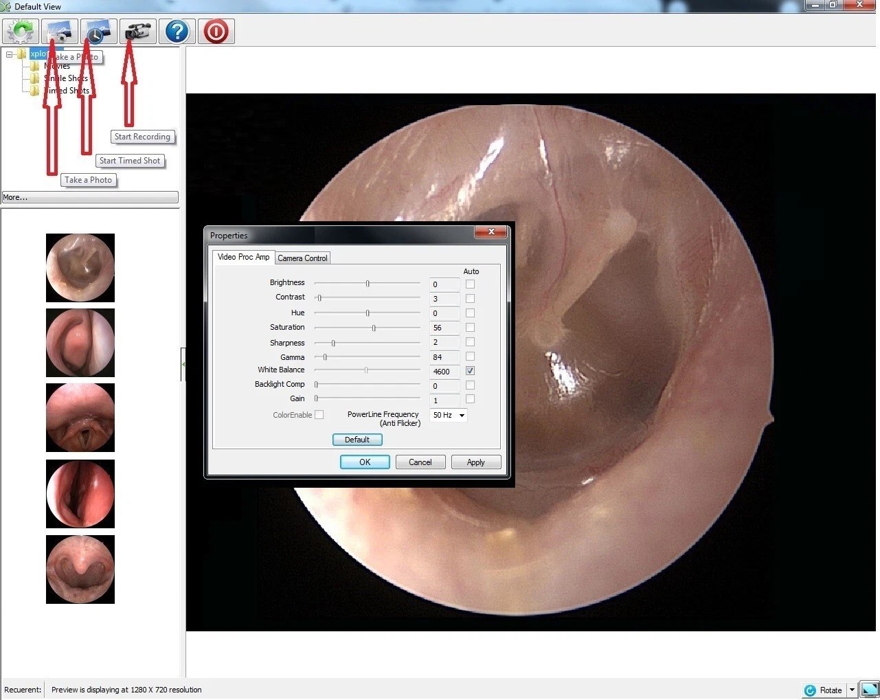 Rigid Endoscope Nasoscope Sinuscope ENT HD USB Camera Head+Coupler+Light Source