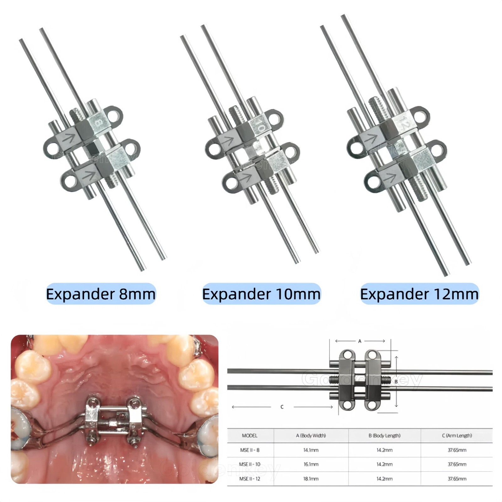 Dental MSE Maxillary Skeletal Expander Orthodontics Expansion Split Adult II BMK