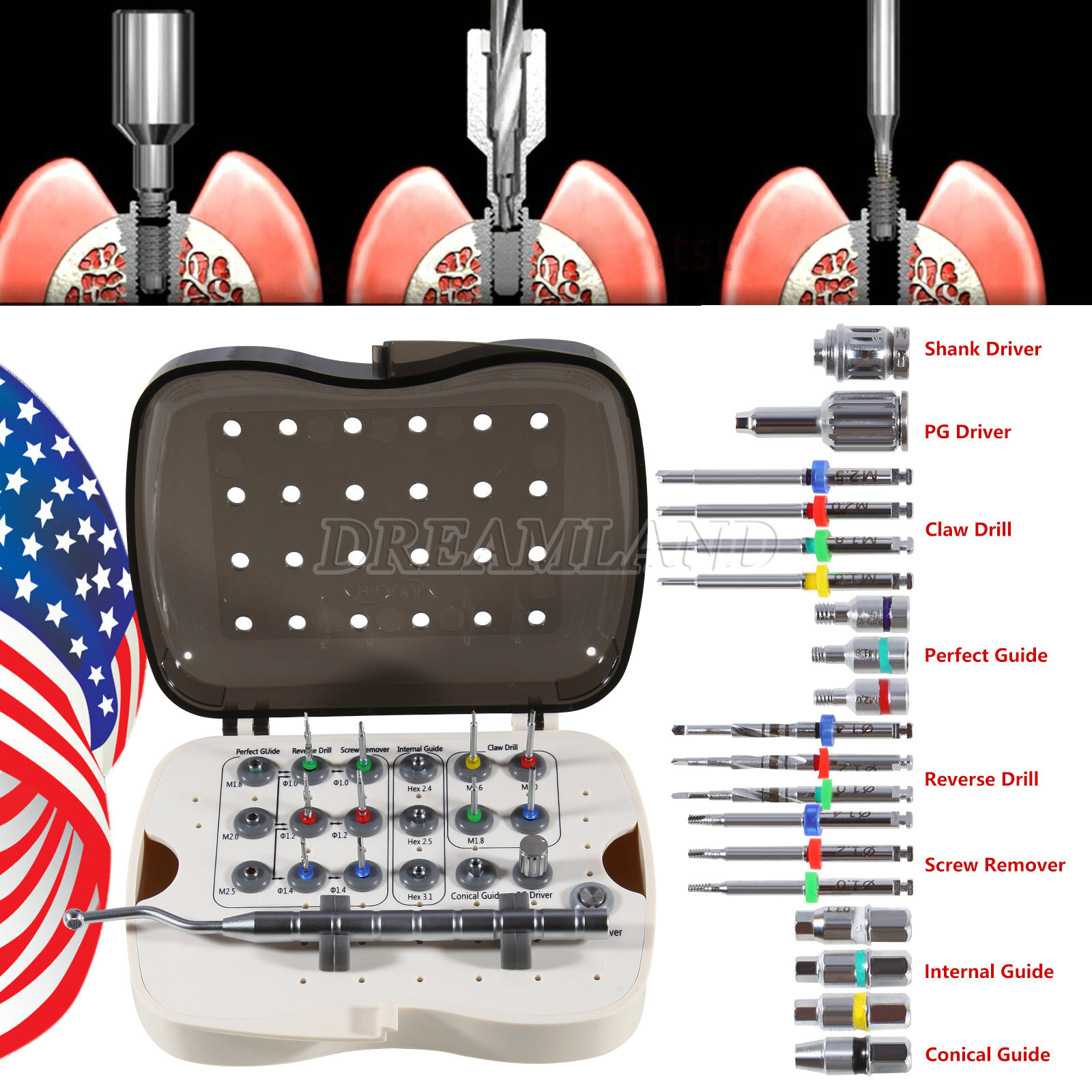 Broken Screw Total Remove Kit SOS Dental Tool Instrument