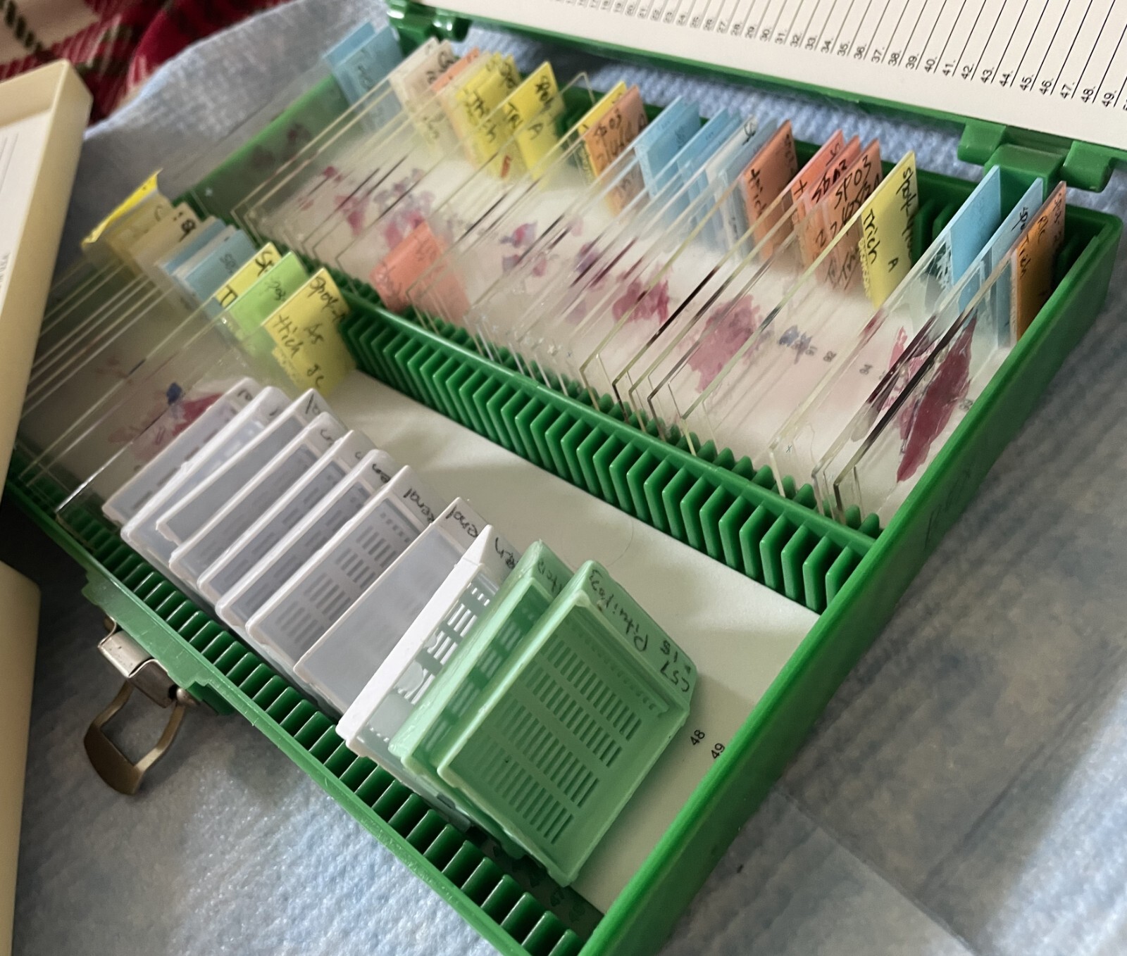 Four Microscope storage boxes with mouse tissues slides, 14,15,16,17