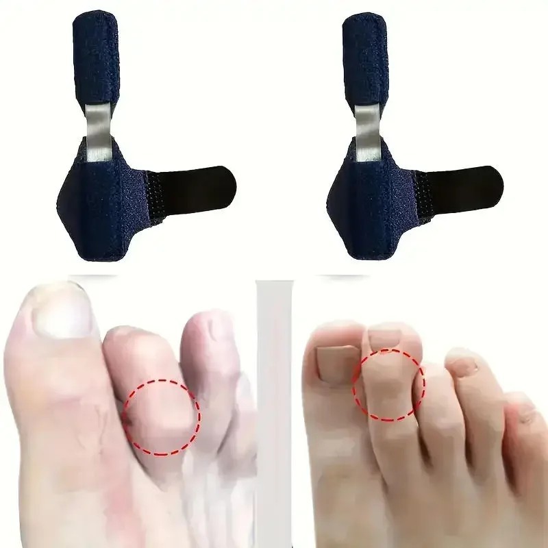 Toe Splint Hammer Toe Corrector Crooked Claw Toe Support Brace Straightener