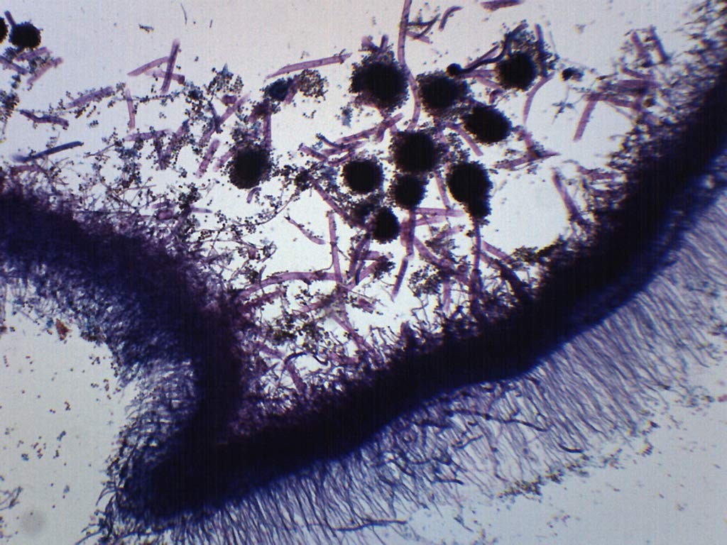 EISCO Aspergillus (Brown Mold), Wholemount - Prepared Microscope Single Slide