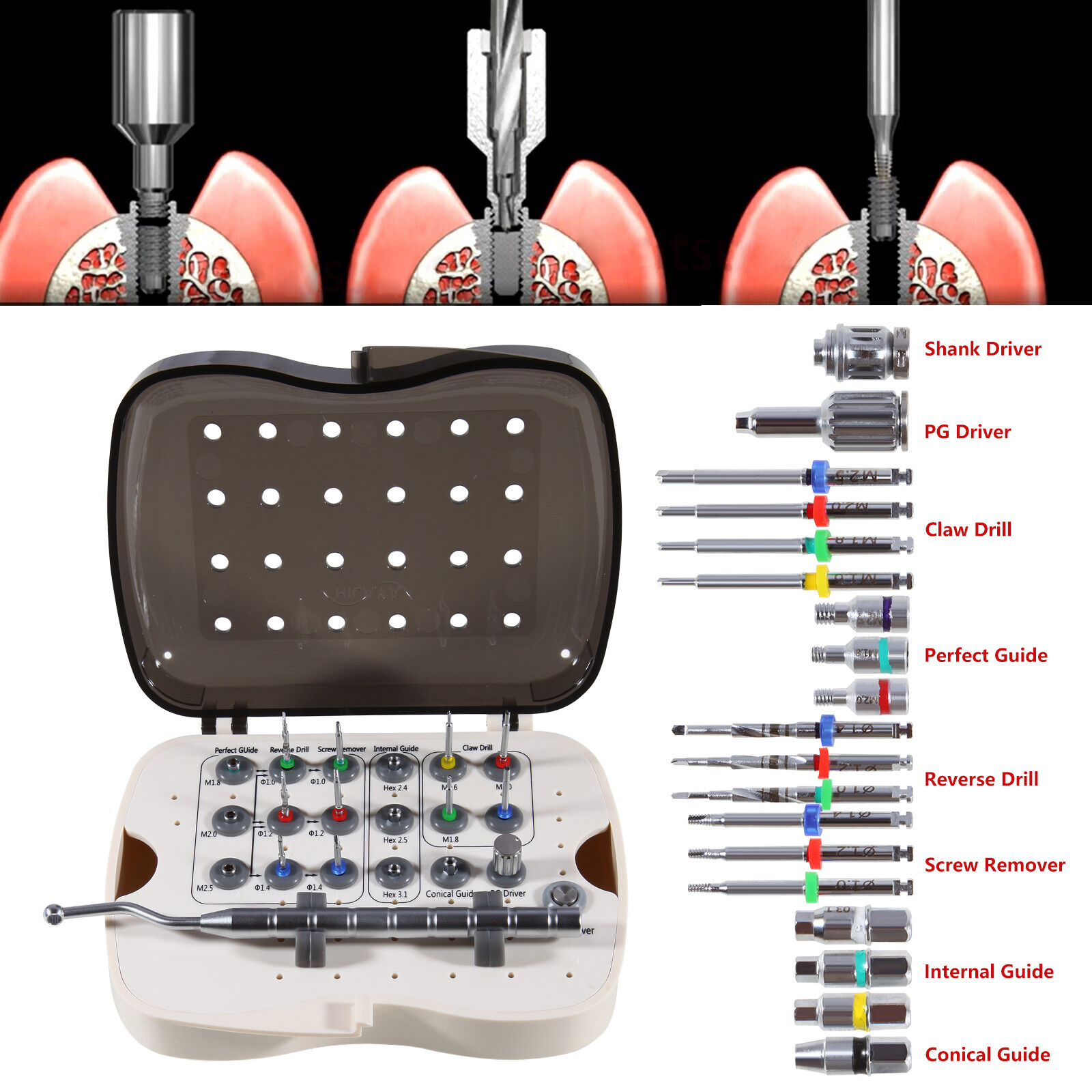 Dental Implant Broken Screw Remover Kit Reverse Drill Guide Driver Neobiotech SR