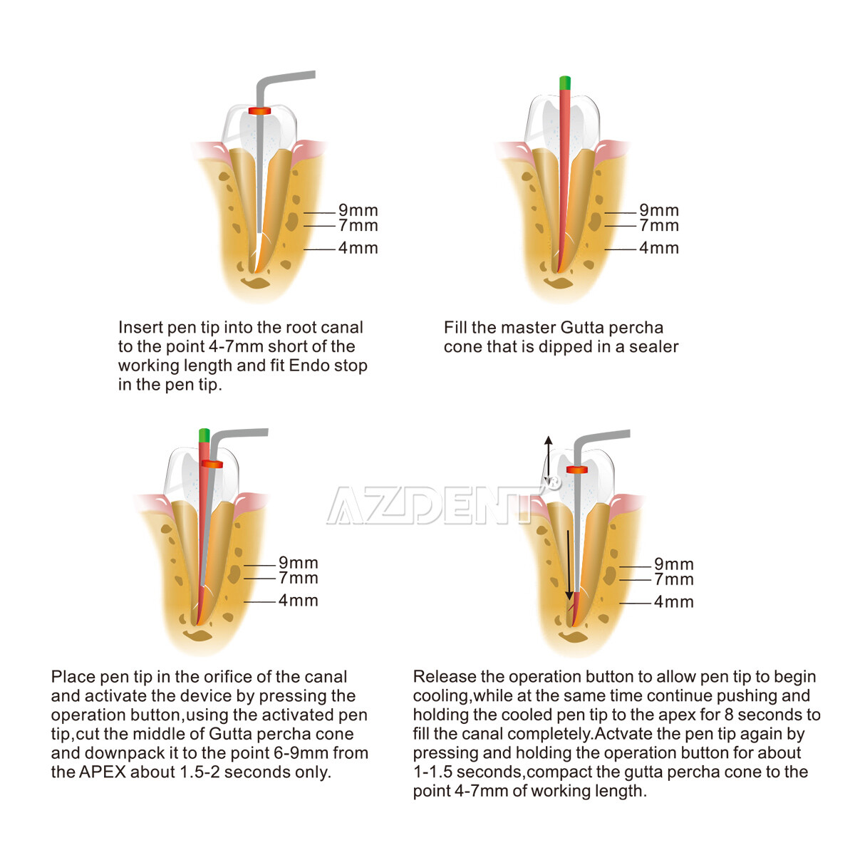 Dental Eodo Obturation System Gutta Percha Endo Heated Pen &2 Tips