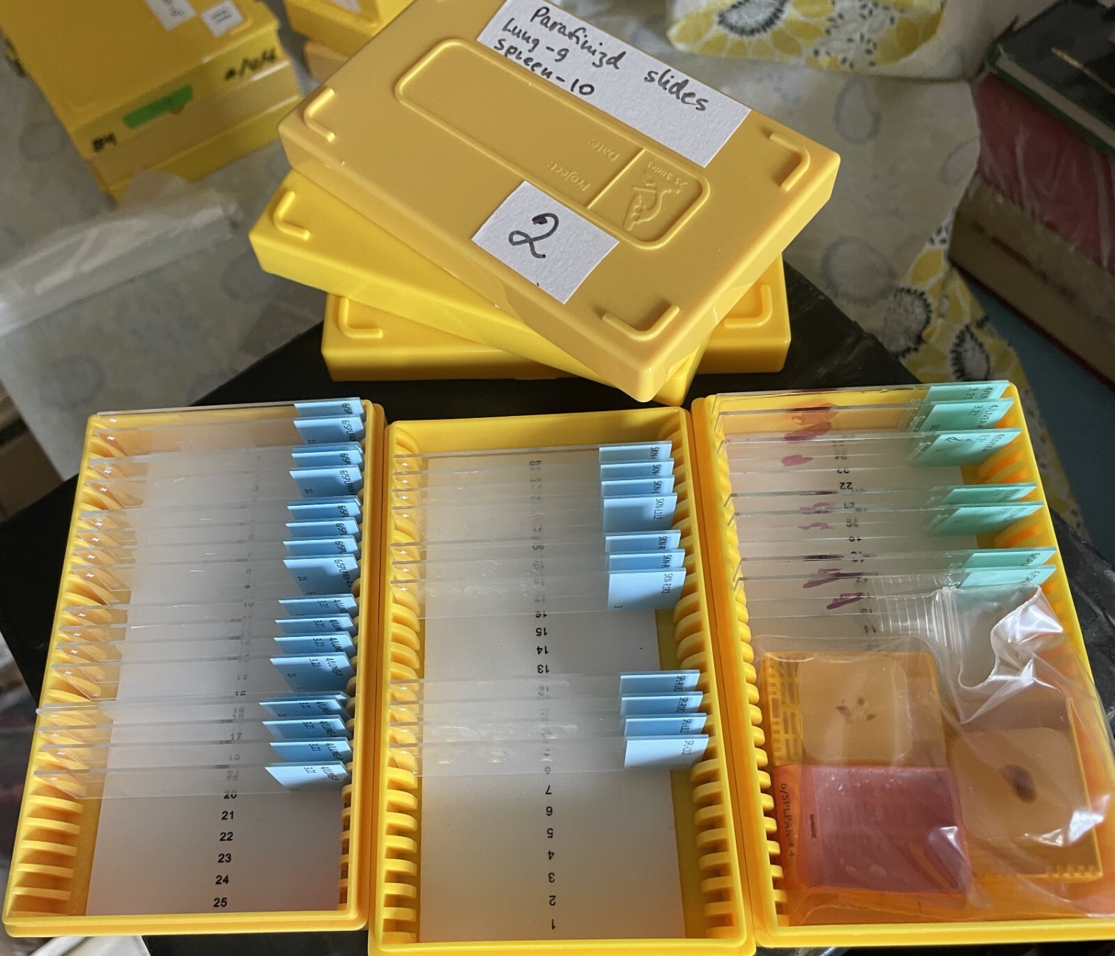 Microscope storage boxes with mouse tissues slides