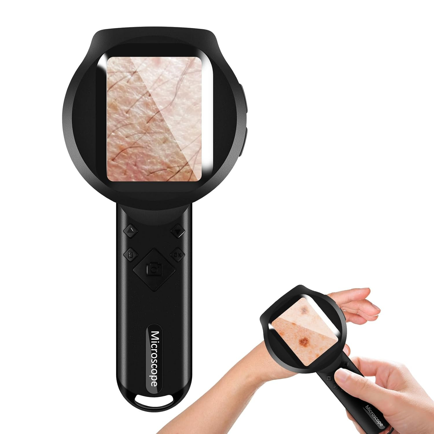 Handheld Dermatoscope, 500X Magnification Skin & Scalp Analyzer for Scalp/Hair T