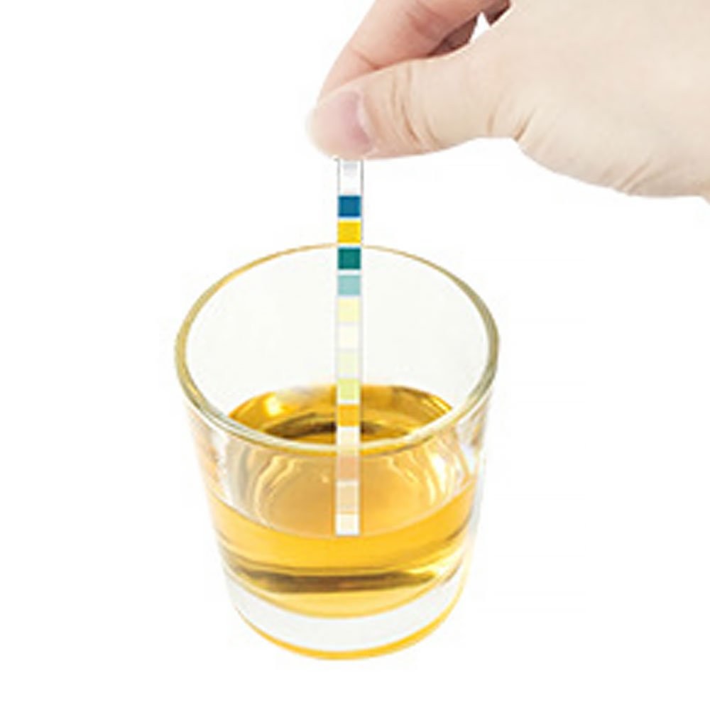 10 in1 Urine Test Strip 10 Parameters Testing pH Protein Kidney & Liver Function