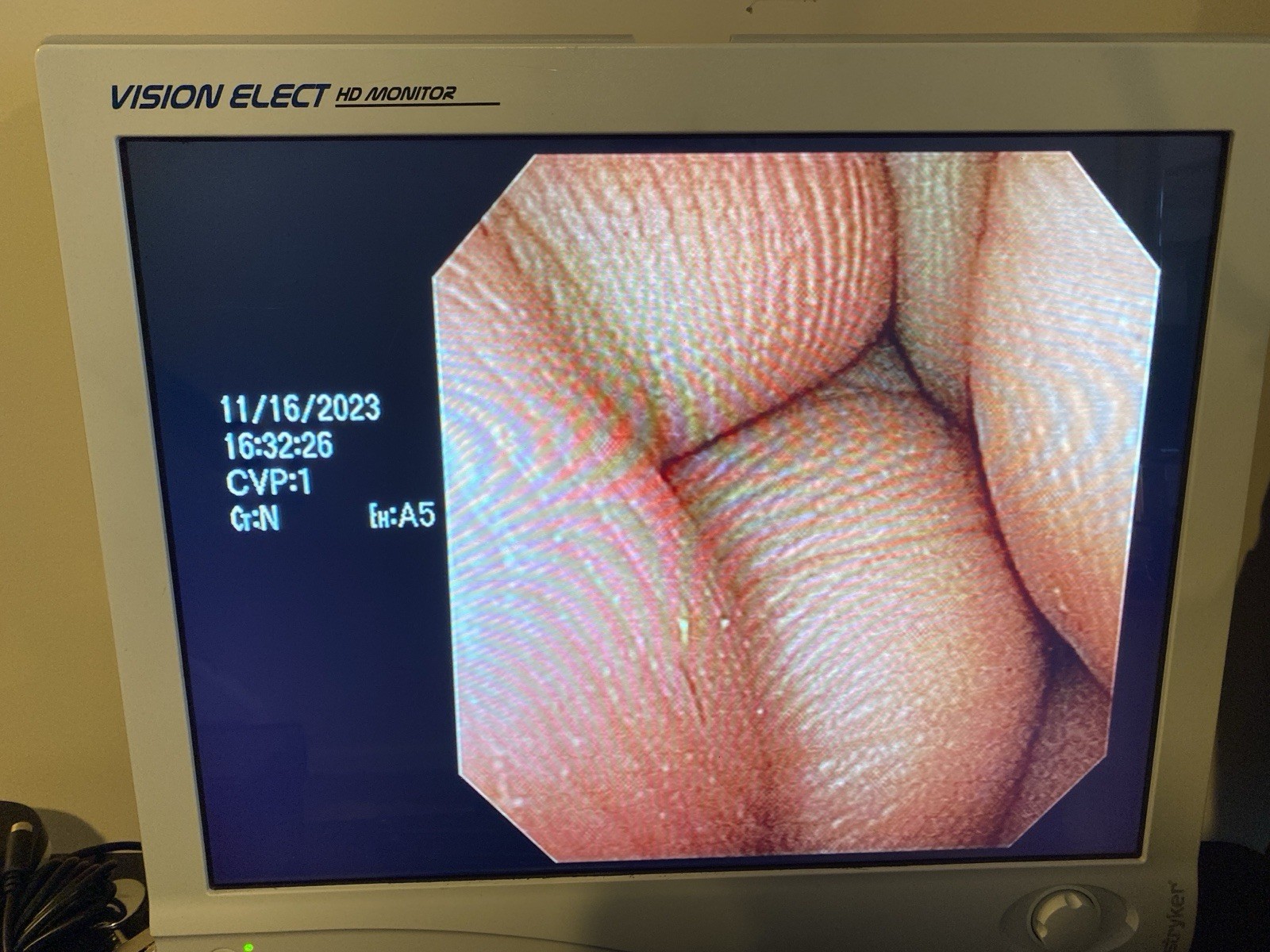 Olympus CYF-V2R Cysto-Nephro Videoscope Endoscope