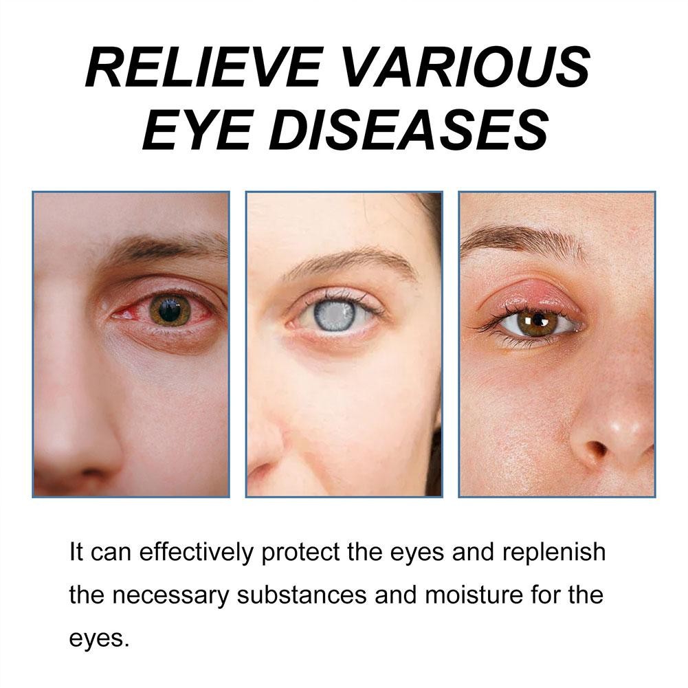 3X Cataract Removal Eye Drop Blurred Improve Vision Restore Relieve Updated