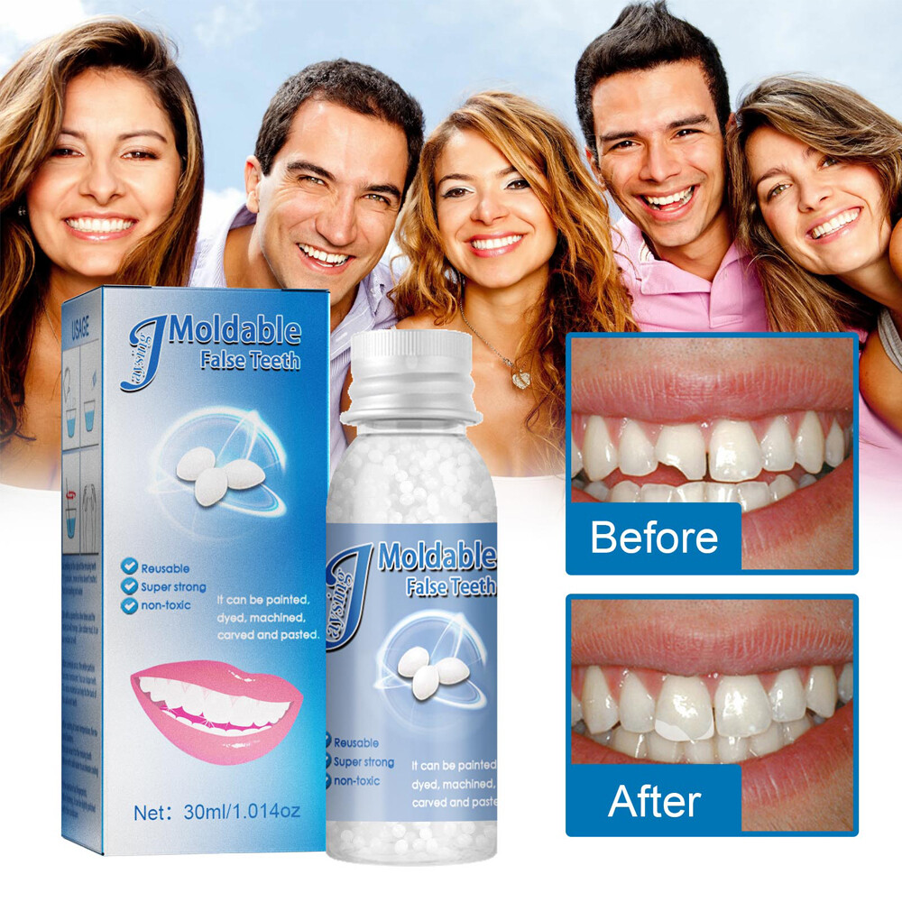 False Teeth Solid Glue Temporary Tooth Repair Resin Moldable Teeth Gap Denture