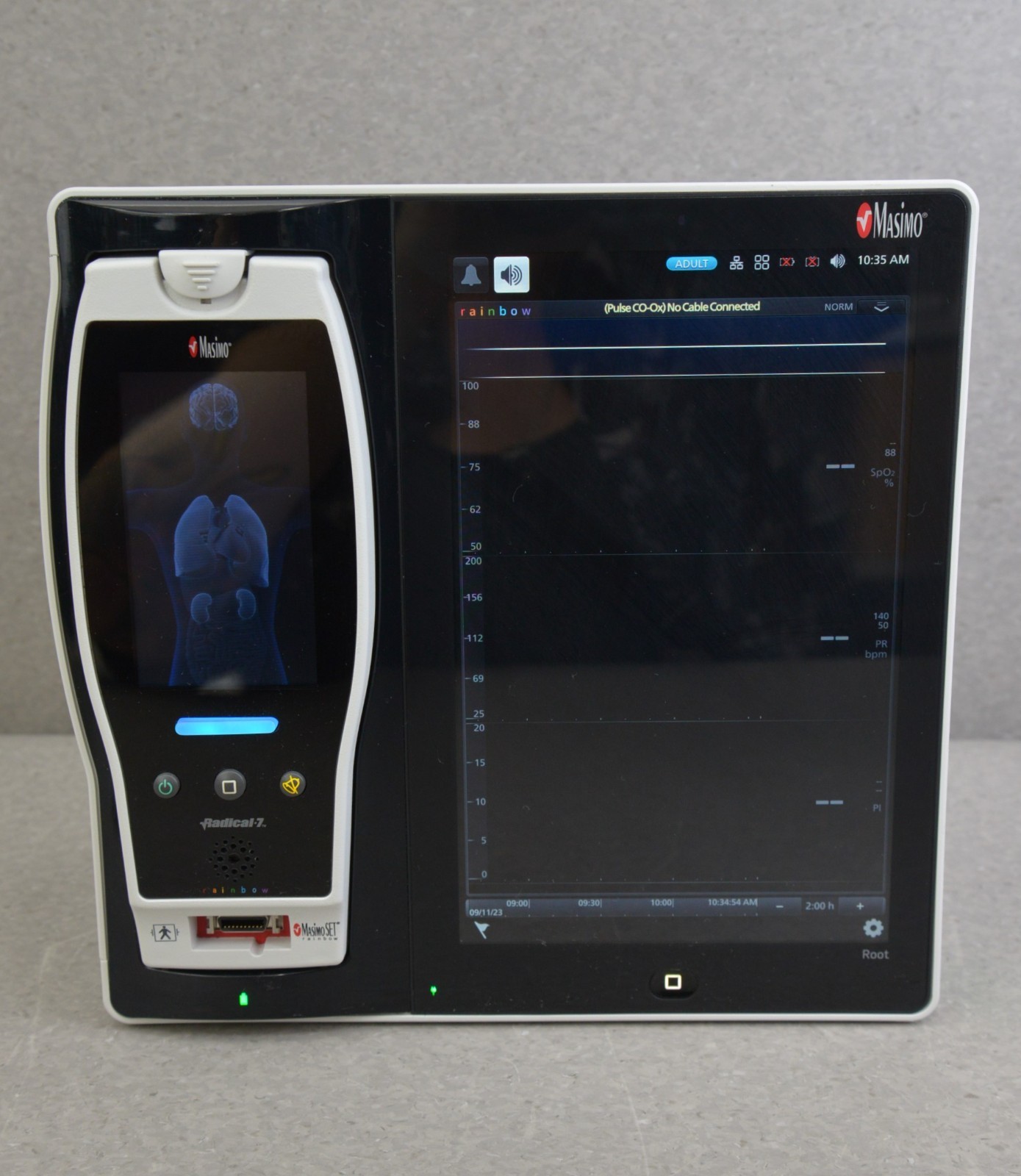 Masimo RDS7A Root Platform W/ Masimo Radical-7 Touch Screen Pulse Oximeter