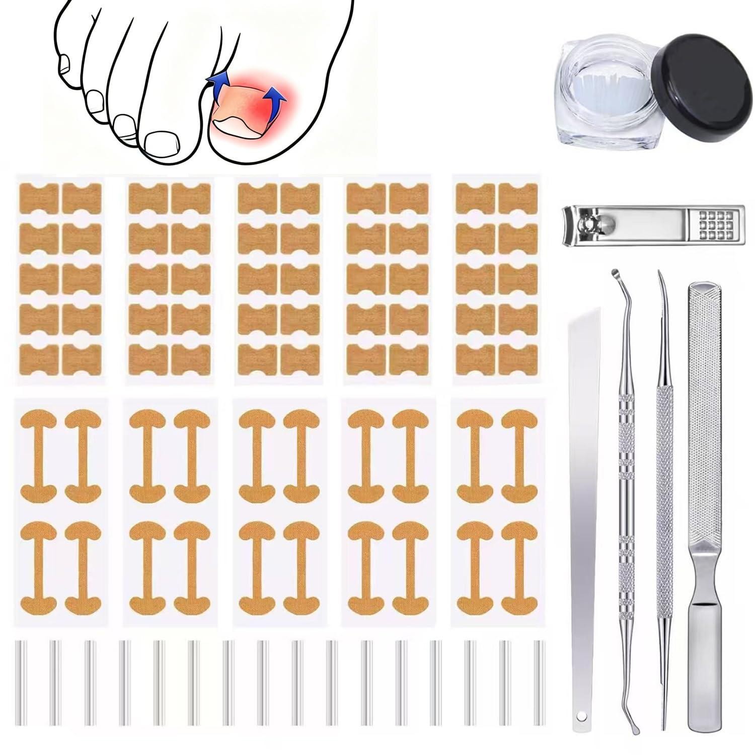 Ingrown Toenail Corrector Set with Correction Strips,professional Ingrown Toe...