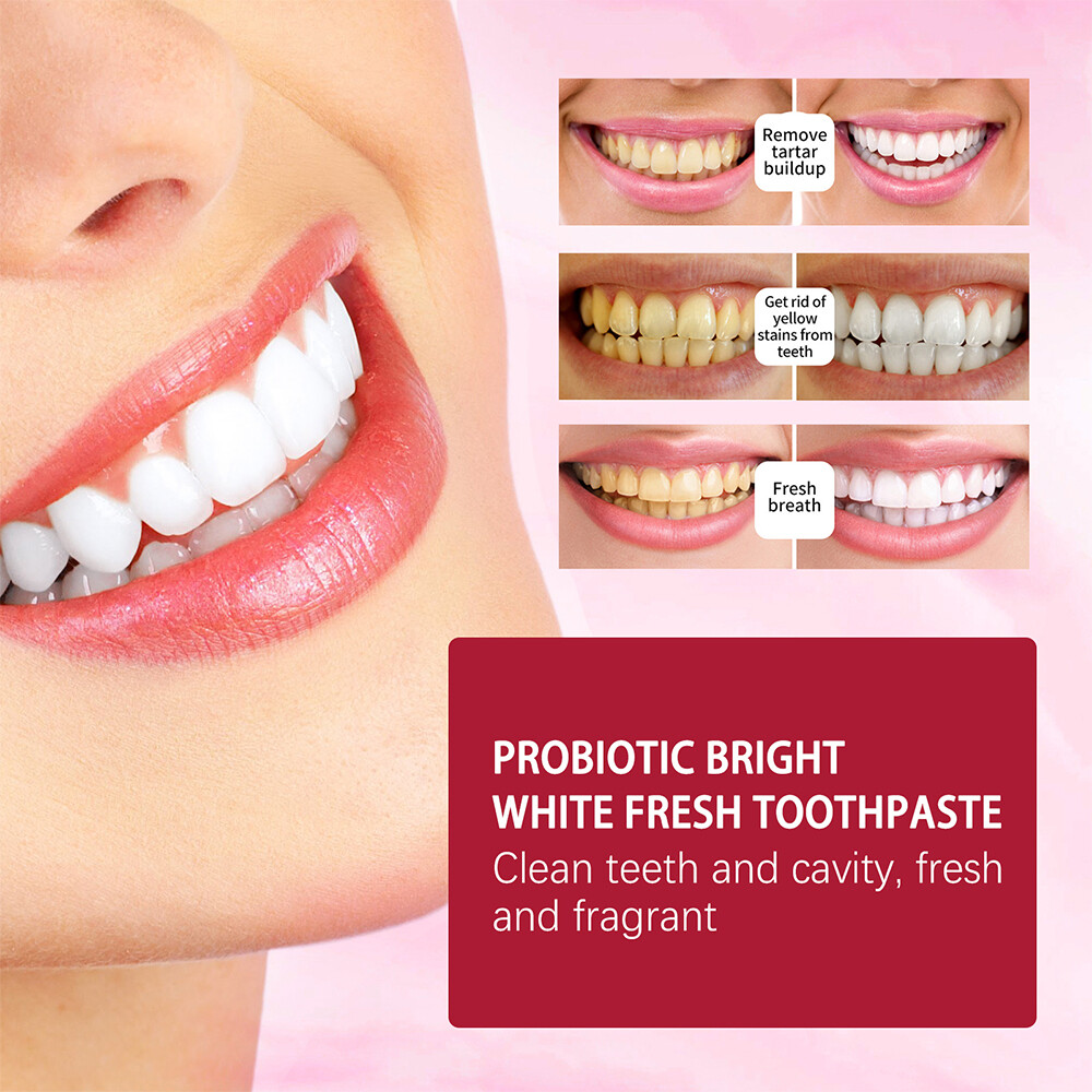 Sp-6 Probiotics Whitening Toothpaste Brightening & Breath Removing Toothpaste US