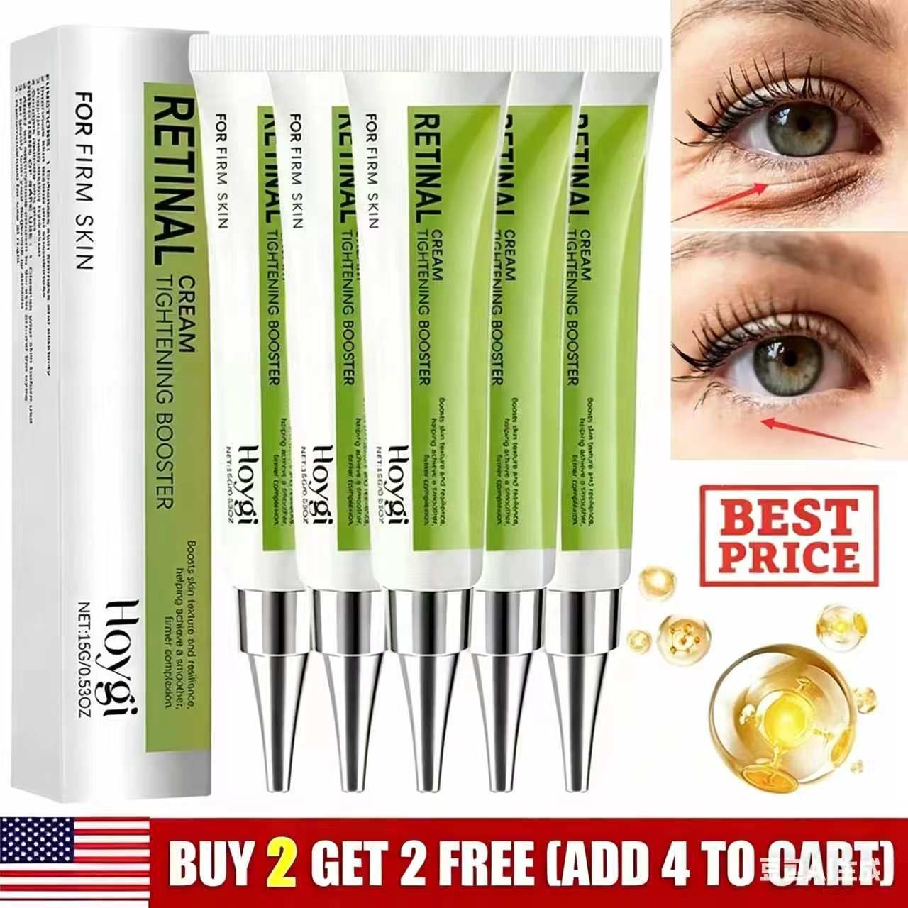 Retinol Eye Cream, Eye Bags Removal To Fight Fine Lines, Wrinkles & Dark Spots