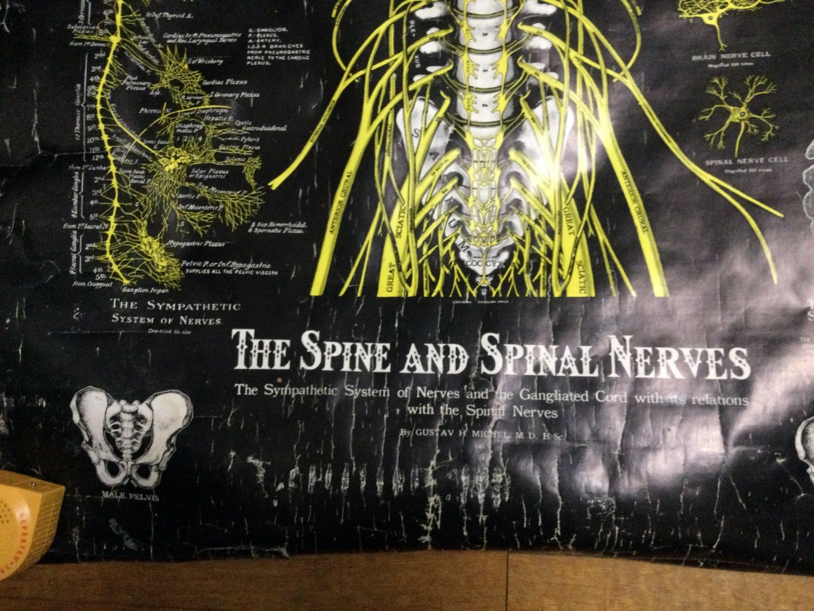 c1964 Vintage Anatomical Pull Down Chart The Spine and Spinal Nerves Dr GHMichel