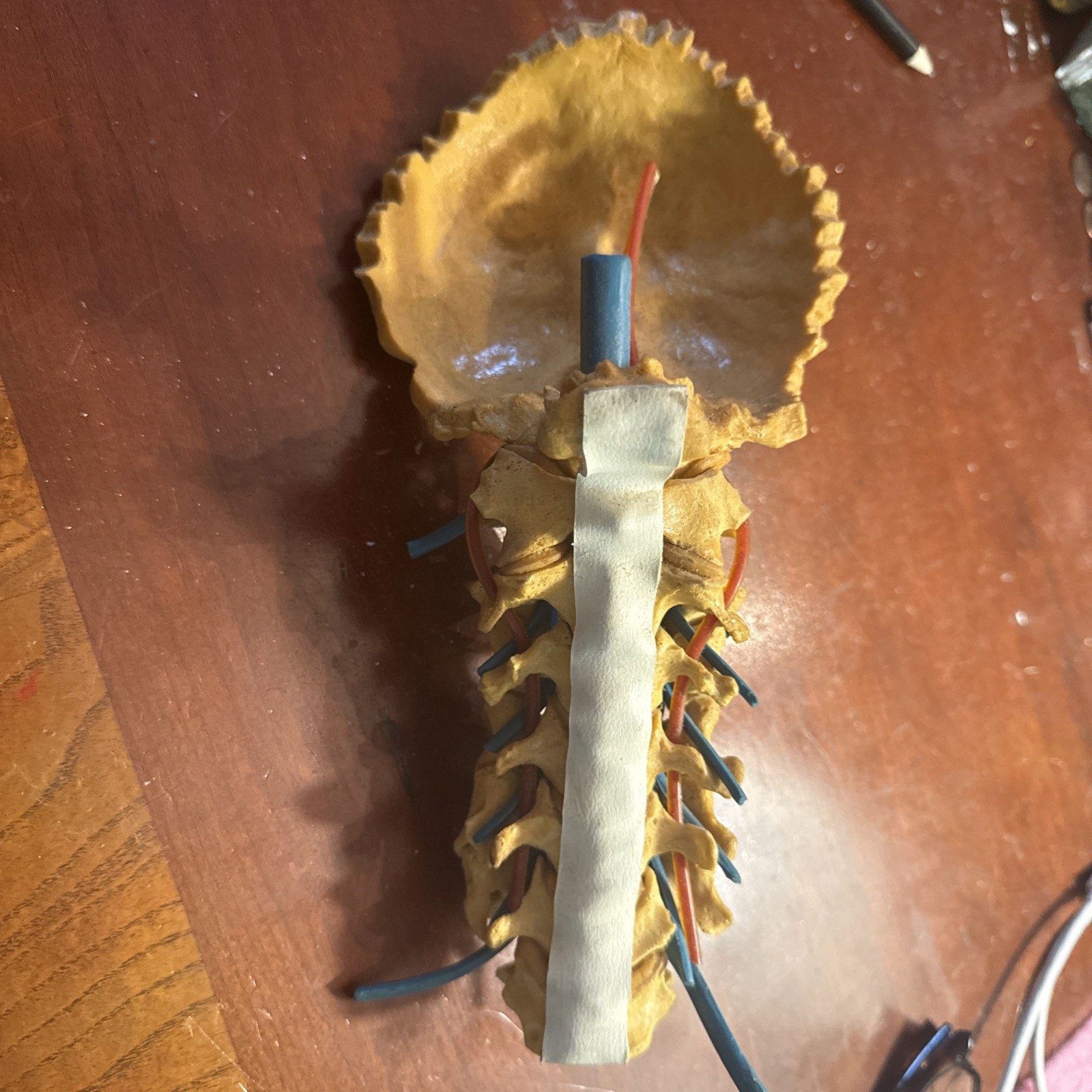 Cervical Spine Model With Fixation