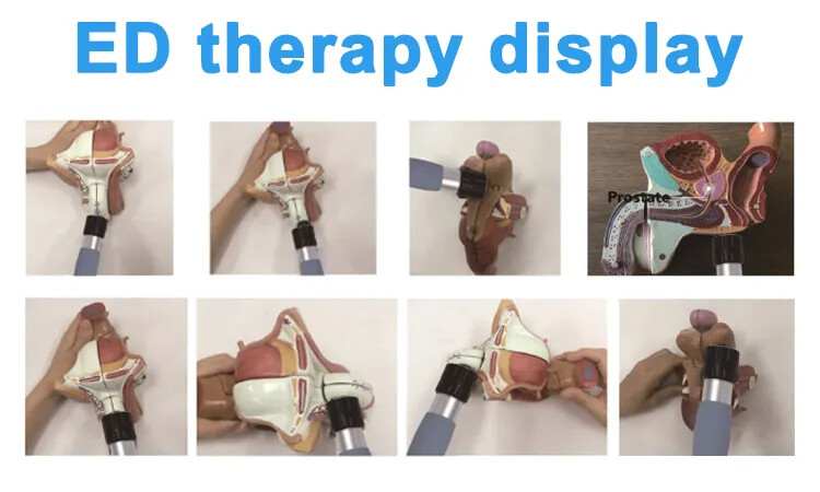 shockwave therapy machine erectile dysfunction ed focused for physical therapy
