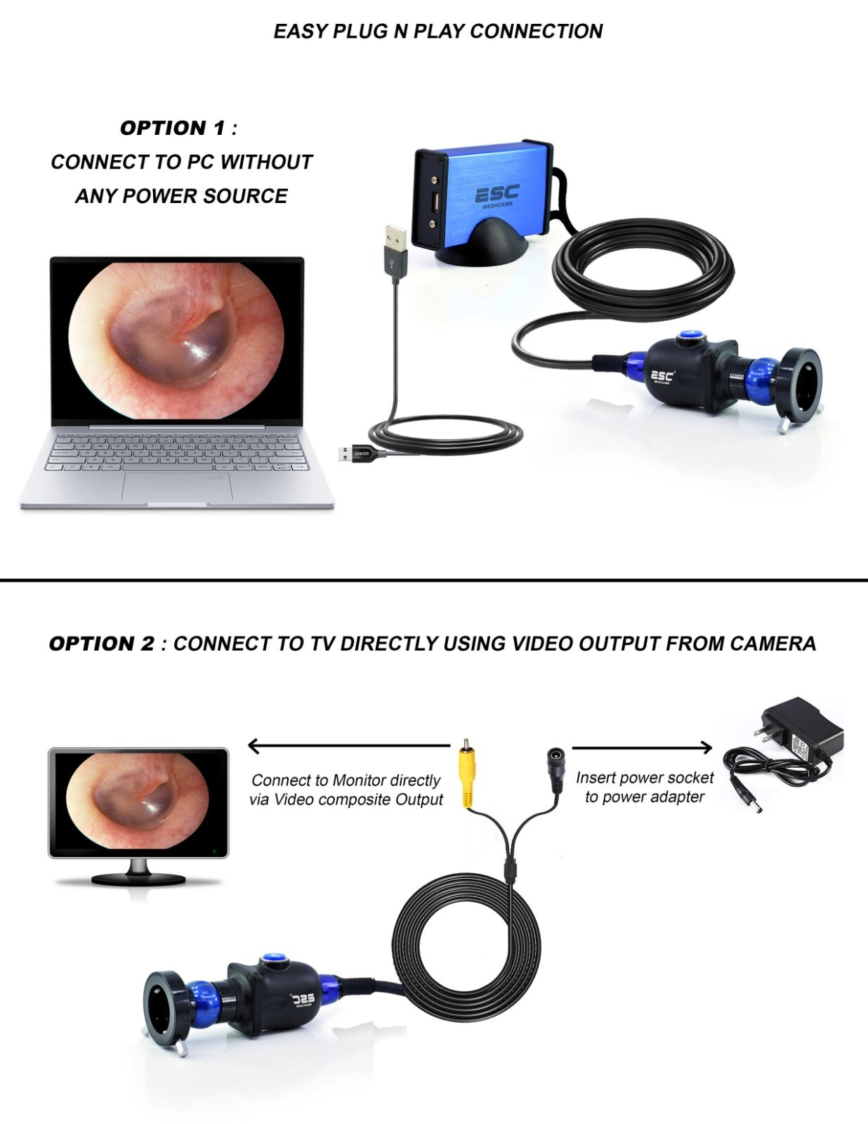 USB Endoscopy Camera HD w/ Portable Cold LED Light Source for Rigid Endoscopes