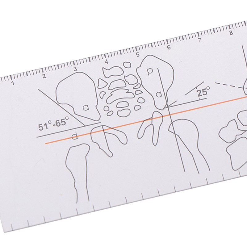 Multi-Ruler Goniometer Angle Medical Ruler Joint Orthopedics Tool Instruments!