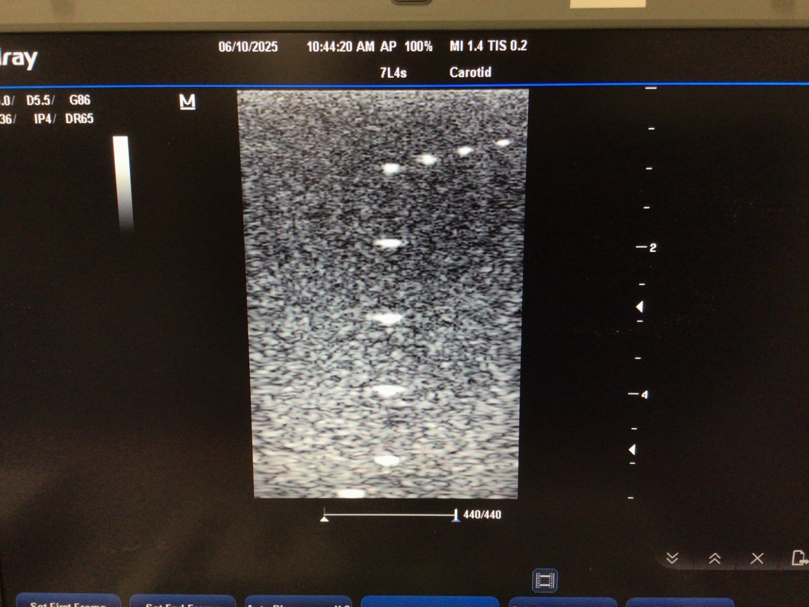 2012 Mindray 7L4s Linear Array Ultrasound Probe