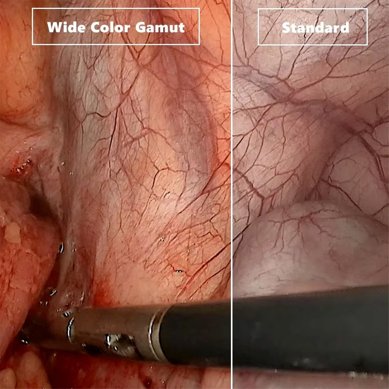 360° Rotating Endoscope - Human/Vet Use for Laryngoscopy & Bronchoscopy