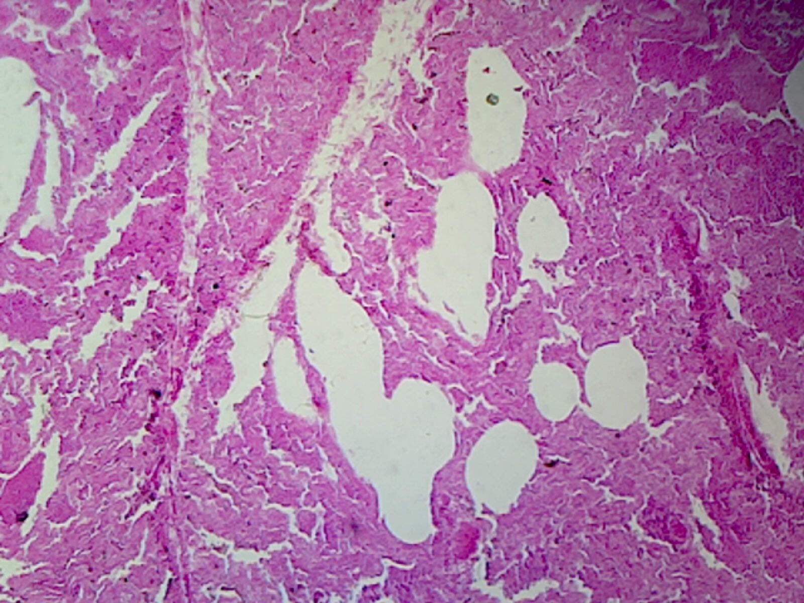 Lung, Human; Showing Alveoli; Section