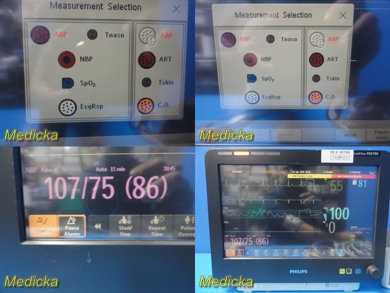 Philips IntelliVue MX700 + X2 (M3002A) + M3012A Monitoring System W/ Leads~38790