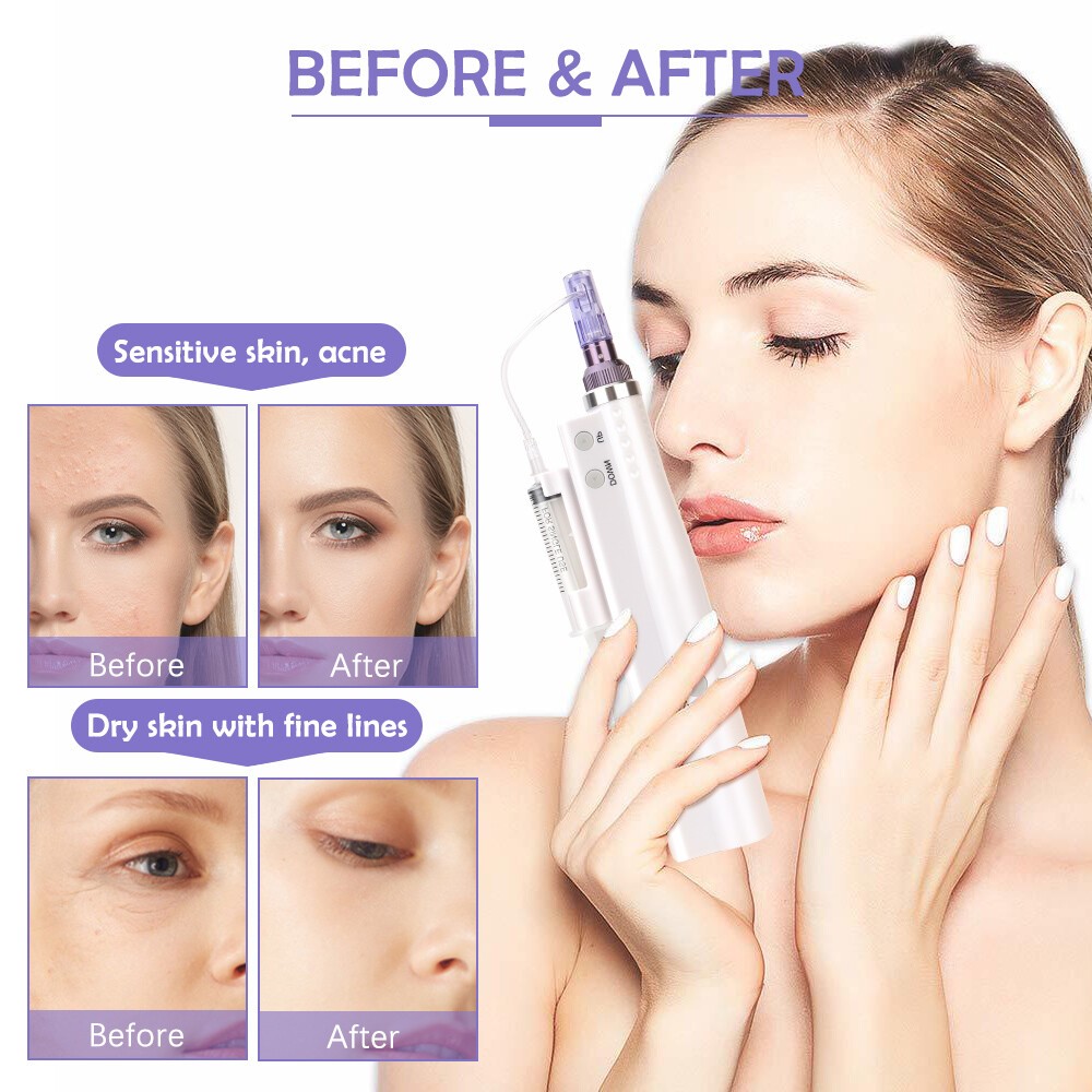 2in1 Mini Electric Water Pen Tool Facial Skin Beauty Machine Facial Cleaning Aid