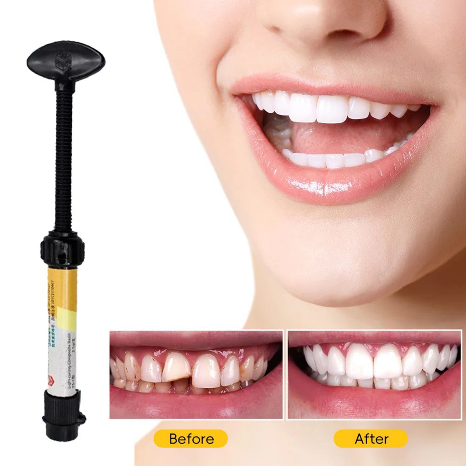 Teeth Resin Tooth Repair Dental Cement Cavity Filling Strong Repair Restoration-