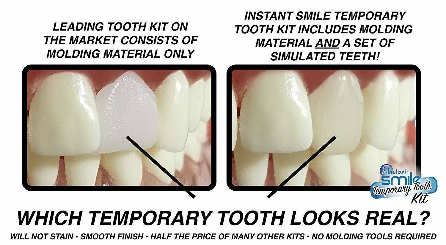 Instant Smile Emergency Temporary Tooth Replacement Kit Teeth