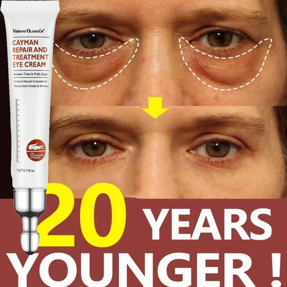 Magic Eye Cream Instant Remove Eye Bag/Dark Circles/Wrinkle/Depuffing Firm Serum