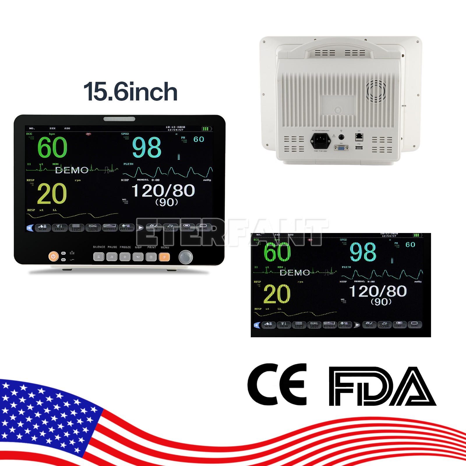 15.6" Patient Monitor ICU CCU Vital Sign for Hospital ECG NIBP RESP TEMP SPO2 PR