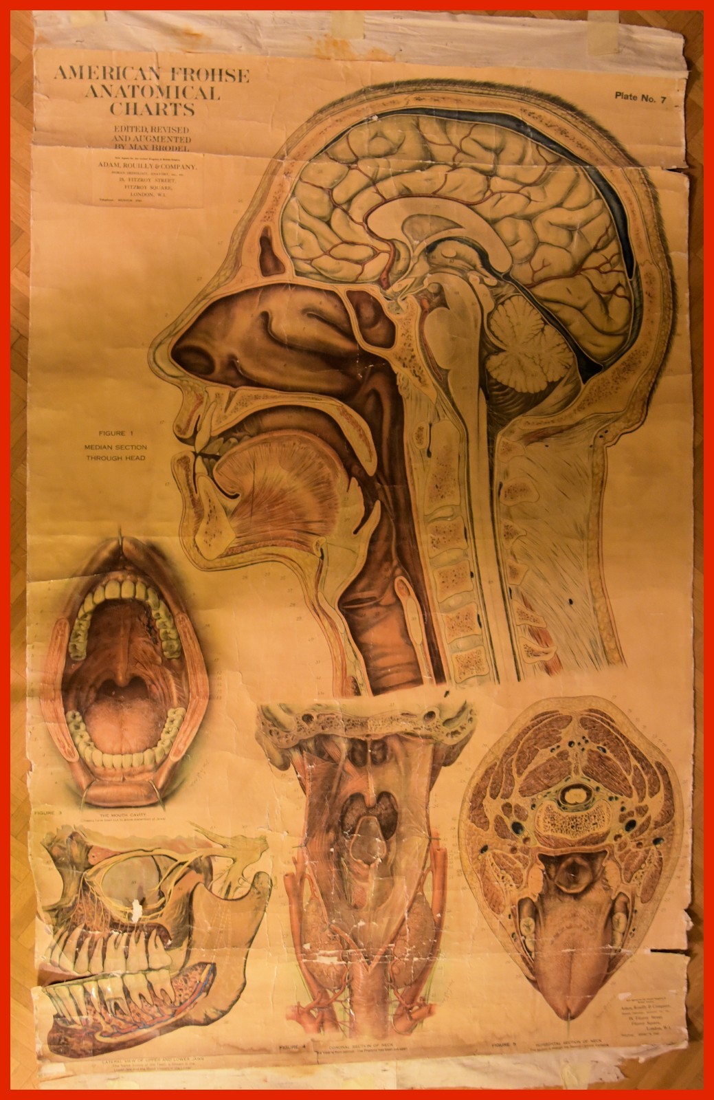 Frohse Anatomical Poster by Max Brodel 1919 Head and Head Cavities
