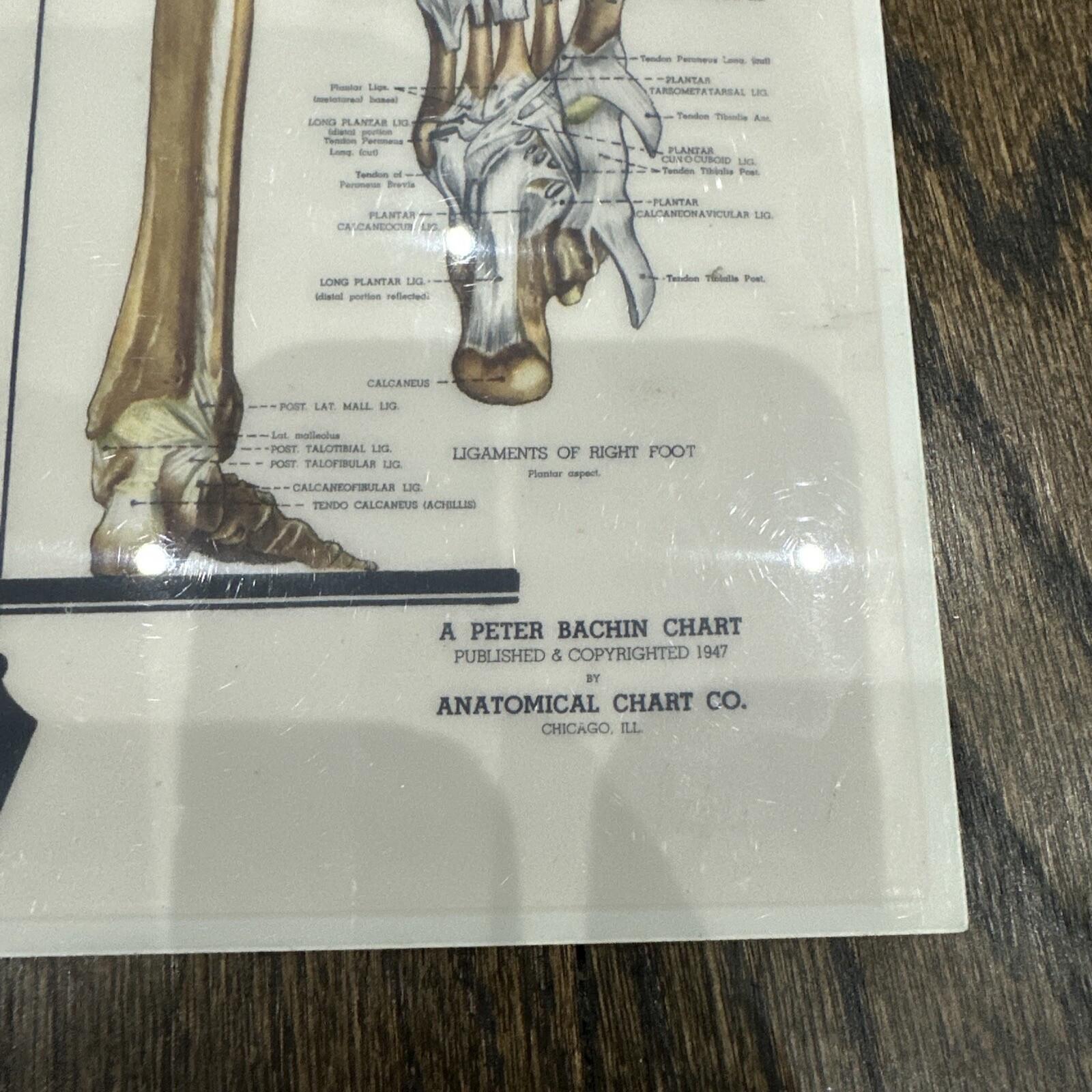 The Skeletal System Peter Bachin 1947 Original Vintage