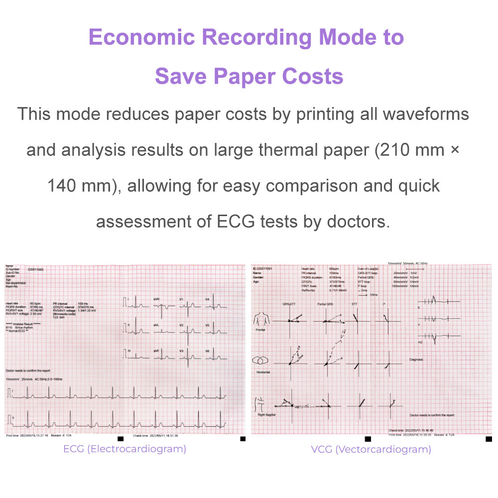 12 channel ECG Machine with interpretation for advisory diagnosis FDA approved