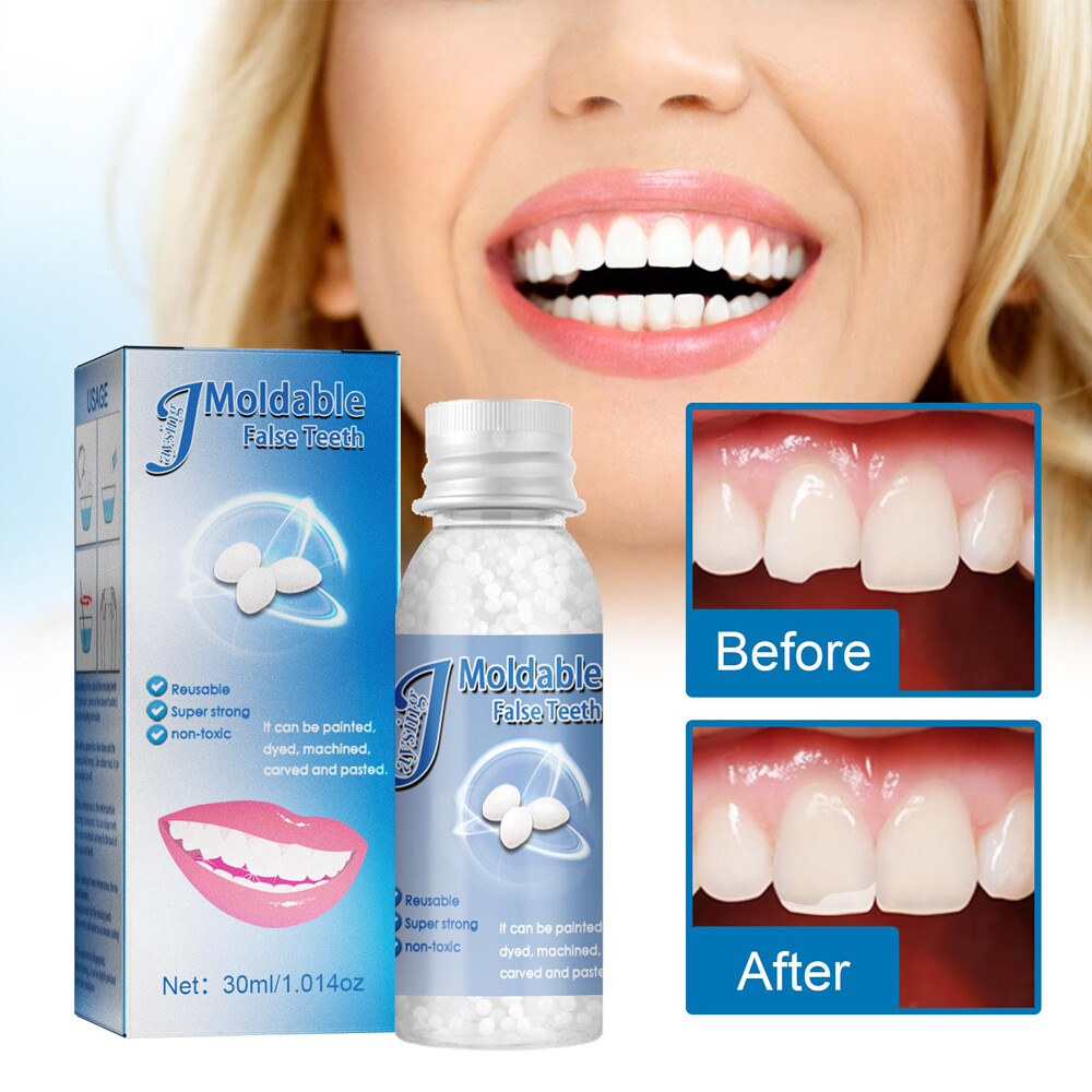 Temporary Tooth Repair Kit Temp Dental Repair Granules Replace Missing DIY Make