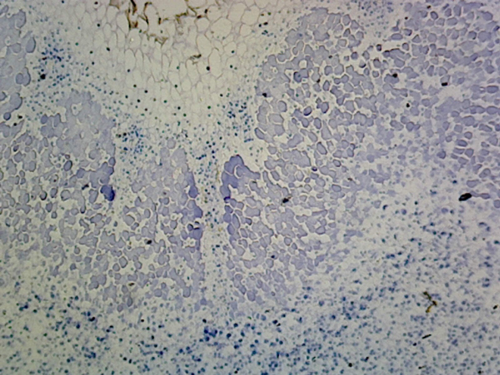 Legume Root Nodule; Section Showing Nitrogen Fixing Microorganism in the Nodules