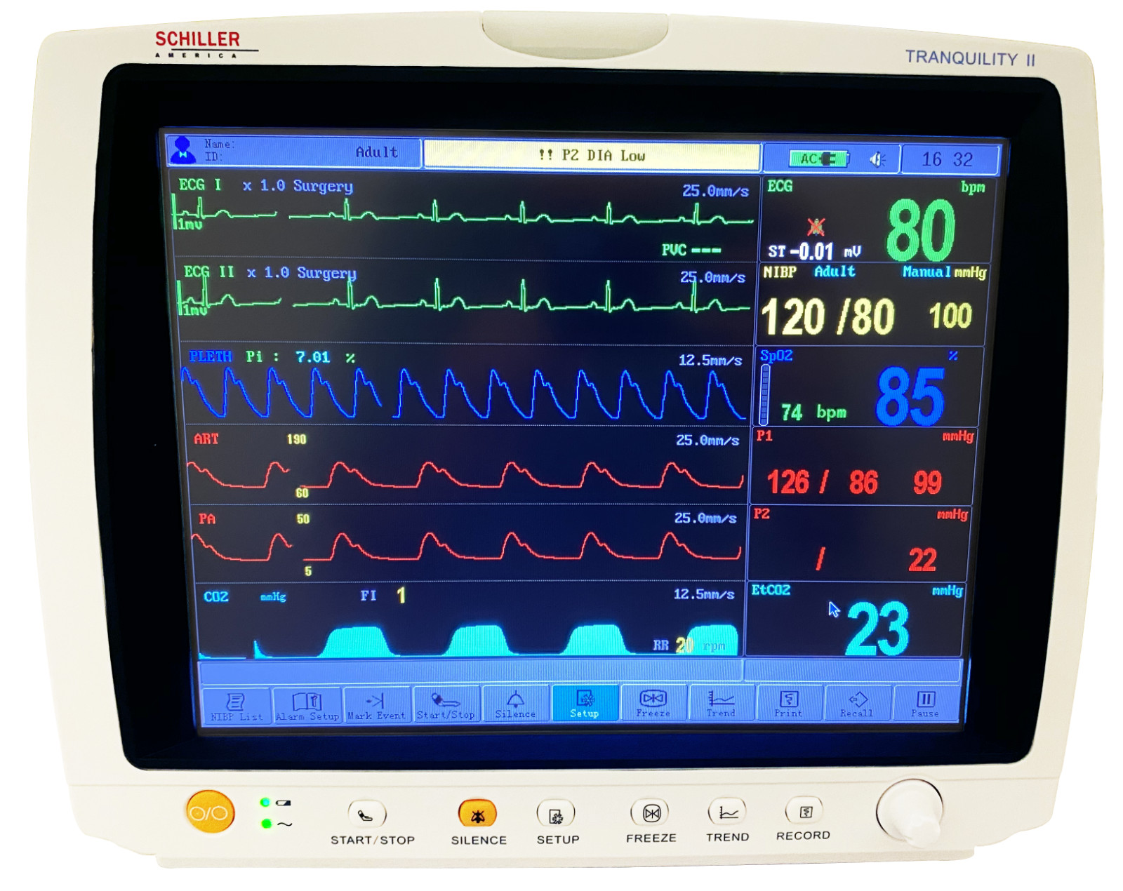 Schiller Tranquility II Patient Monitor 0-750000ETM