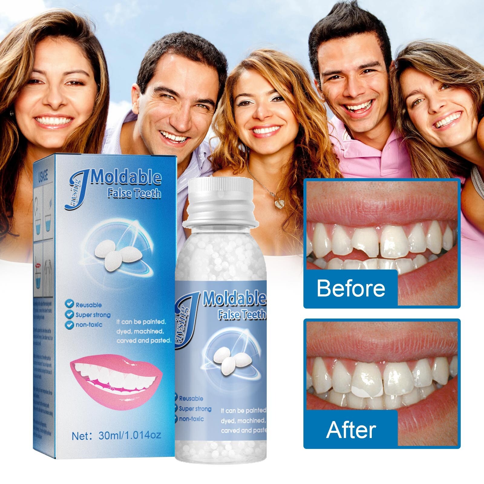 2x Resin False Teeth Solid Glue Temporary Tooth Gap Filler Tooth Repair Moldable