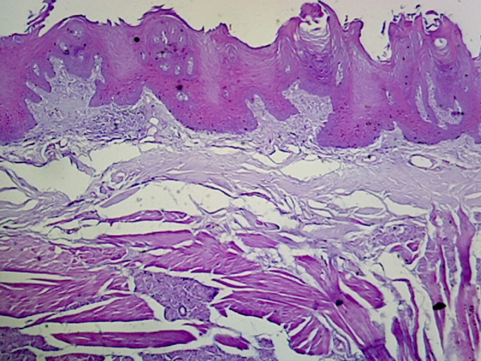 Tongue, Human; Longitudinal Section