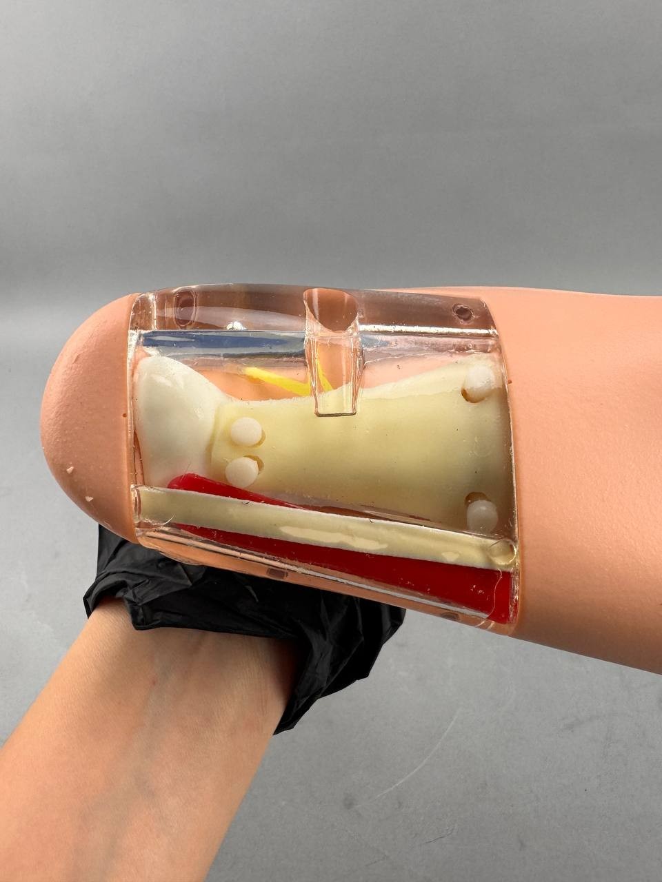 MicroAire Smart Release W/ Leg and Case